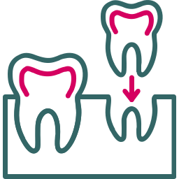 implantes icono