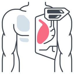 implantar Ícone