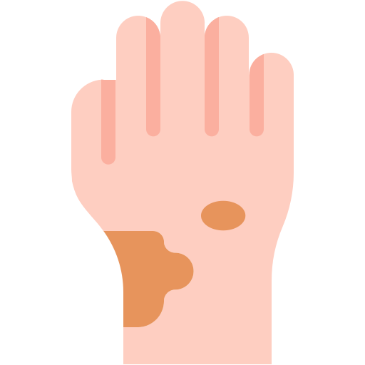 Skin disease Generic color fill icon
