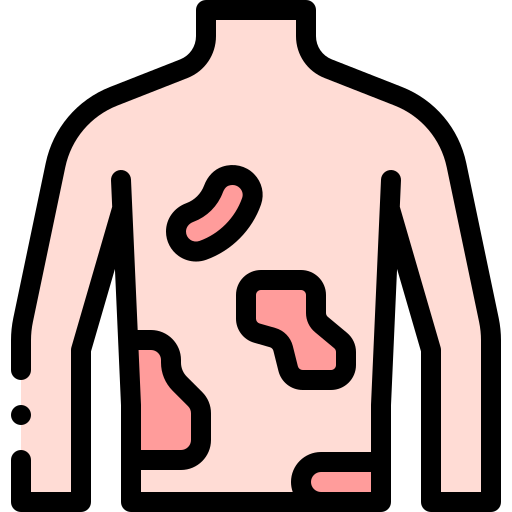 蕁麻疹 Detailed Rounded Lineal color icon