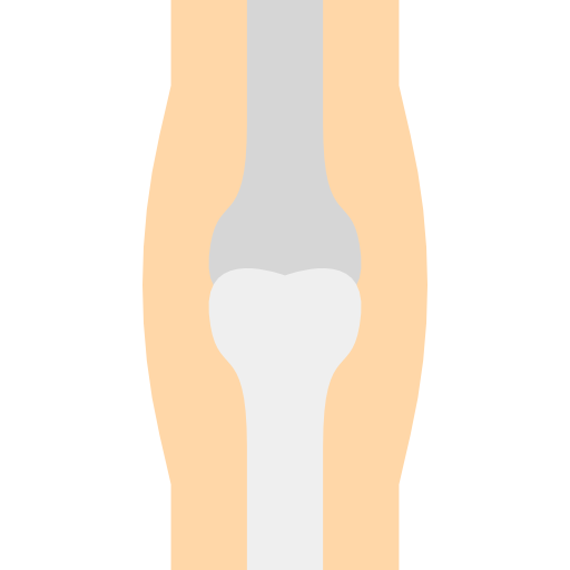 osteoporose Ultimatearm Flat icoon