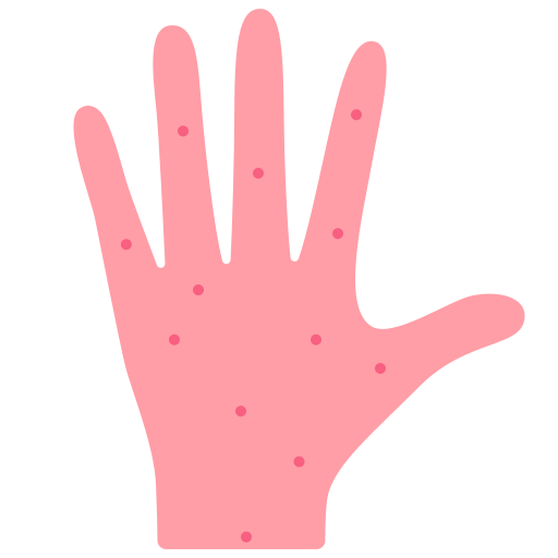 Skin allergy Victoruler Flat icon
