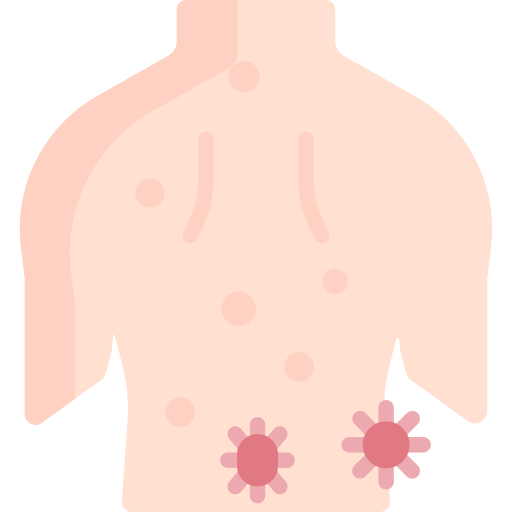 allergia cutanea Special Flat icona