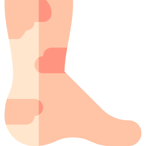 urticaria Basic Straight Flat icono