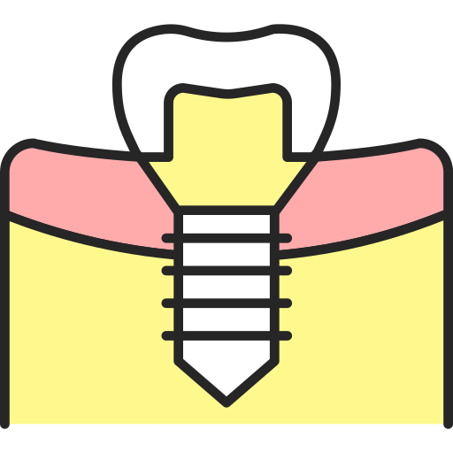 zahnimplantat Generic Outline Color icon