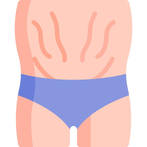 Stretch marks Special Flat icon