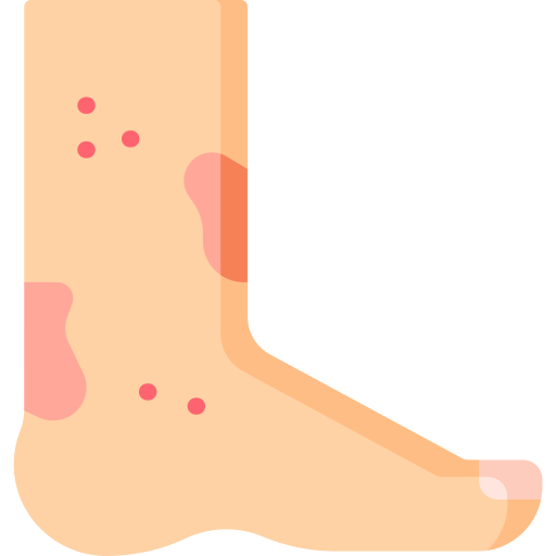 dermatitis Special Flat icon