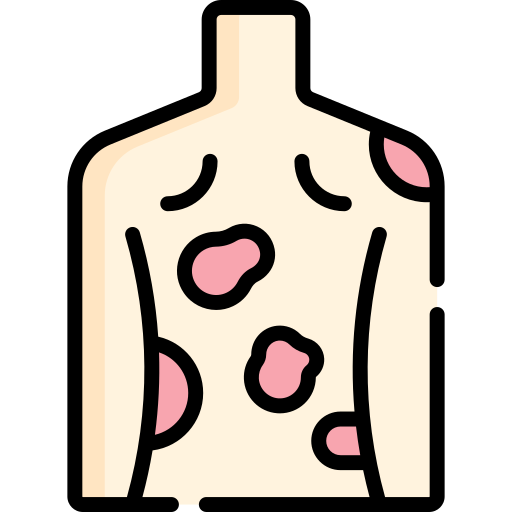 蕁麻疹 Special Lineal color icon