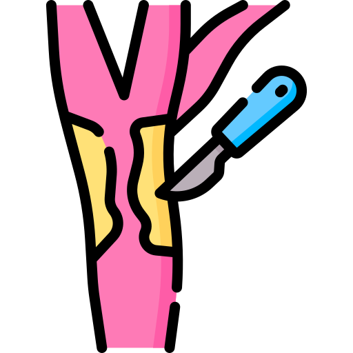 endarterectomía carotídea Special Lineal color icono