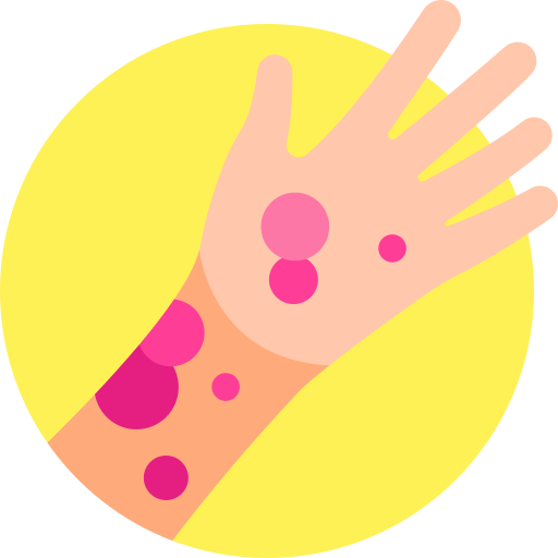 Allergy Detailed Flat Circular Flat icon